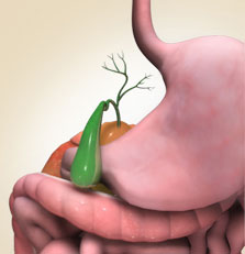 gall-bladder-surgery